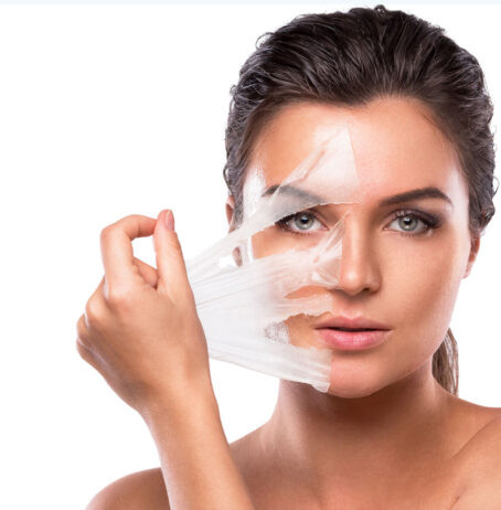 Laser peel 454x462 1.jpg