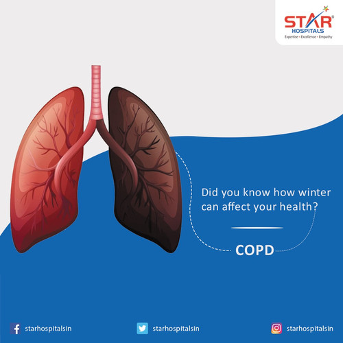 Best Pulmonology and Lungs Hospital in Hyderabad.jpg