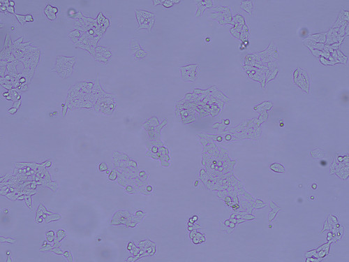 phase contrast 10x narrow aperture b.jpg