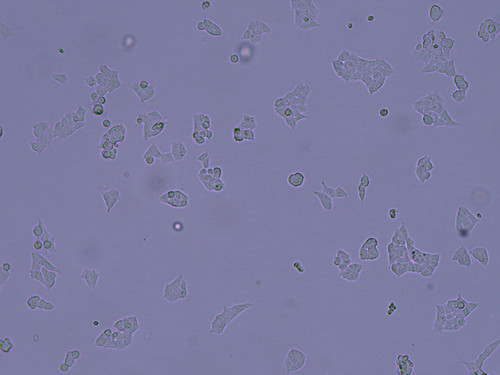 phase contrast 10x narrow aperture a.jpg