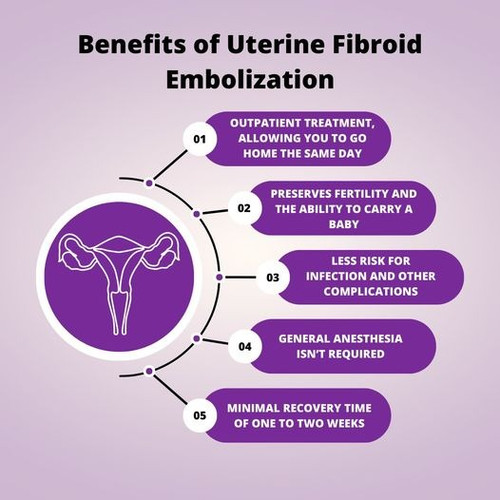 Best Of Uterine Fibroid Embolization.jpg