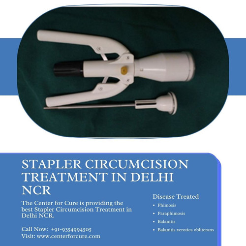 Stapler Circumcision Treatment in Delhi NCR.jpg