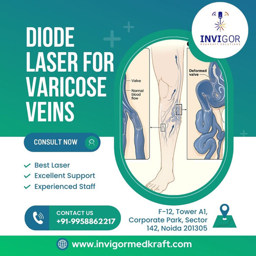 Diode laser for varicose veins (1).jpg