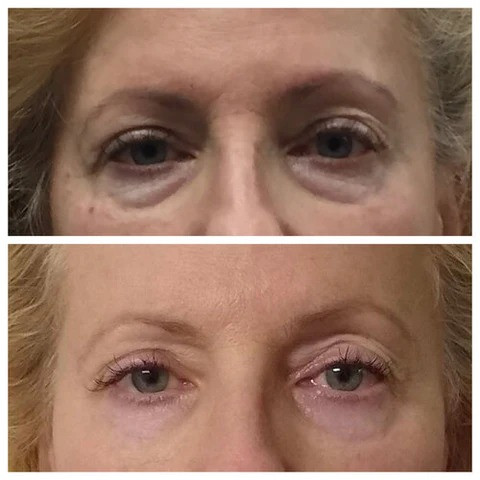 ANTESEDEPOIS2 FC 480x480.jpg