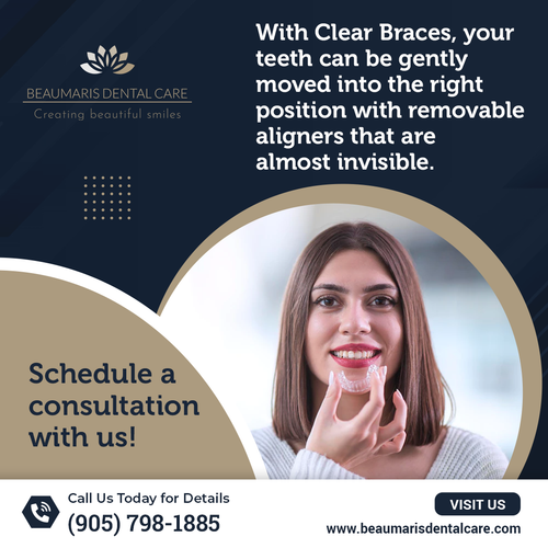 Invisalign Feb W2.png