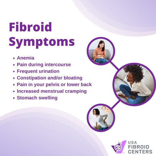 Fibroid Symptoms.jpg