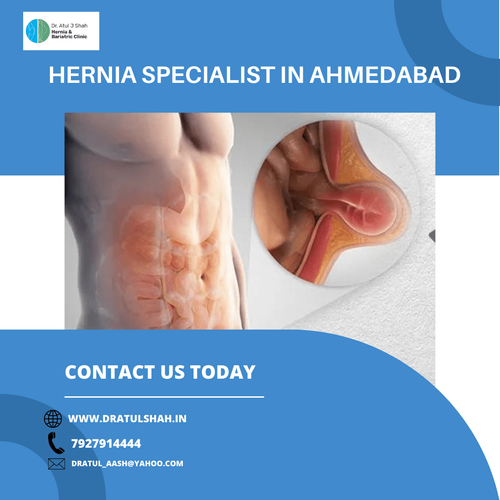 Hernia Specialist in Ahmedabad.png
