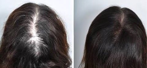produto 35.jpg