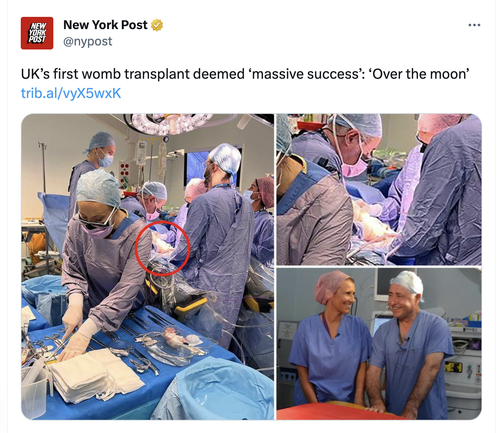 Monosnap New York Post on X: %22UK’s first womb transplant deemed ‘massive success’: ‘Over the moon’.png