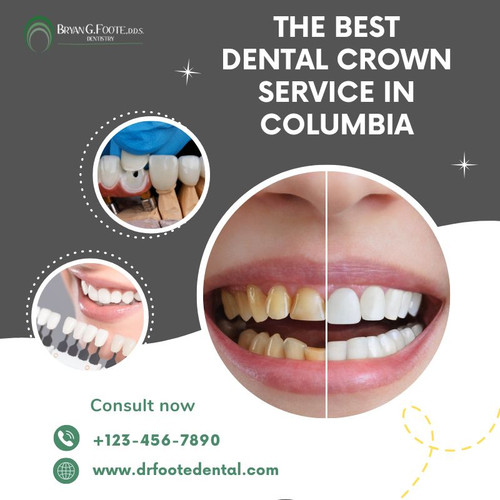 The best Dental crown service in Columbia.jpg
