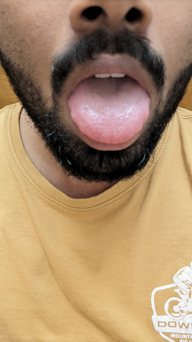 1000036533.1