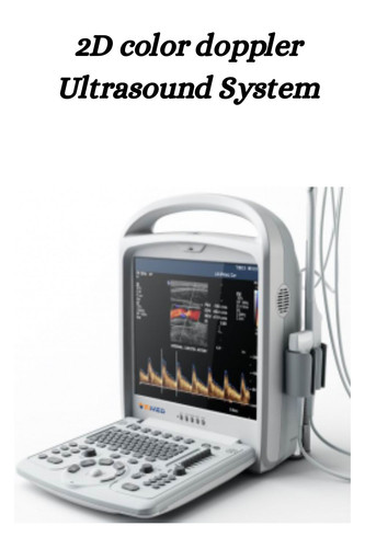 2D color doppler Ultrasound System.jpg