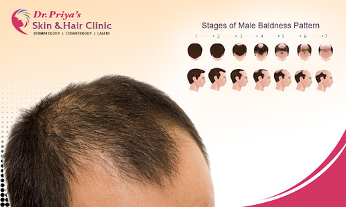 Hair Loss Treatment.jpg