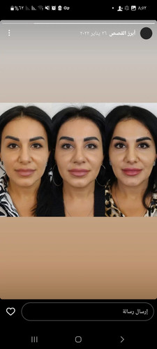 images%2Fimage 1704045240169.jpg