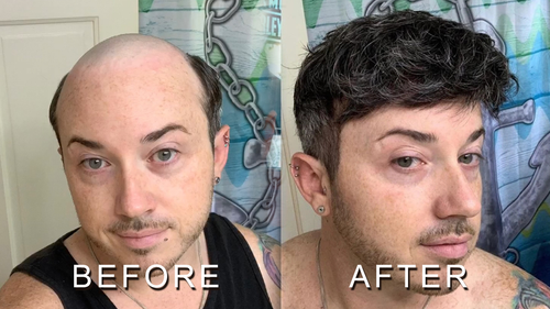 How does a men frontal hairpiece work and who is it for.png