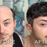 How does a men frontal hairpiece work and who is it for