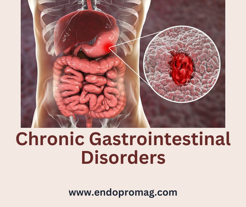 Surviving With Chronic Gastrointestinal Disorders.jpg