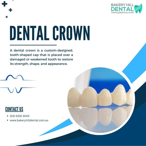 Dental Crown.jpg