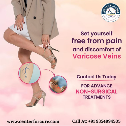 Varicose Veins Laser Surgery Lucknow.jpg
