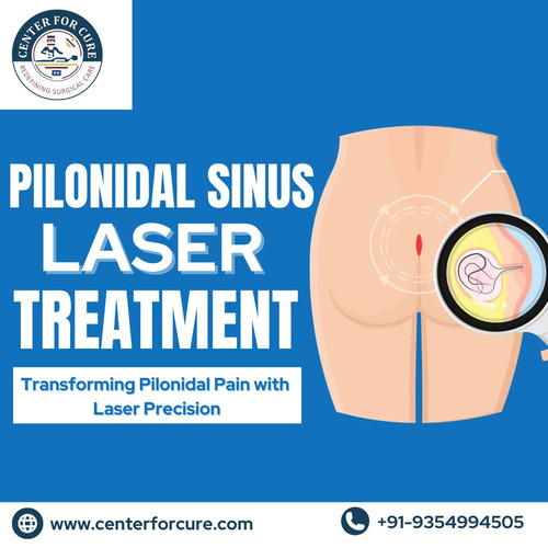 Best Pilonidal Sinus Laser Treatment in Noida.jpg