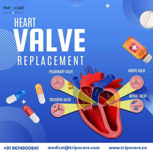 Get Heart Valve Treatment with the help of Tripncare.jpg