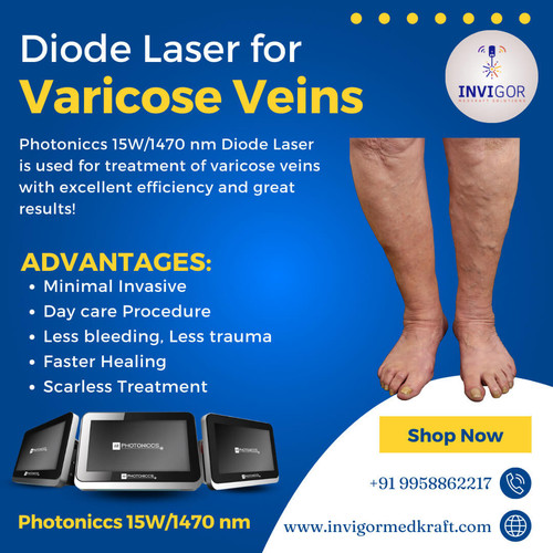 Diode Laser For Varicose Veins.jpg