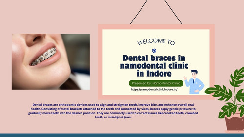 Dental braces in namodental clinic in Indore.jpg