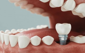 Cleaning Teeth Bass Hill.jpg