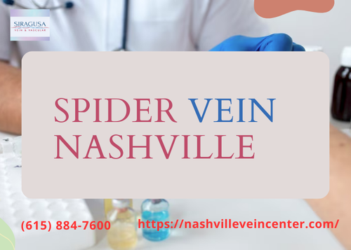 Spider Vein Nashville.png
