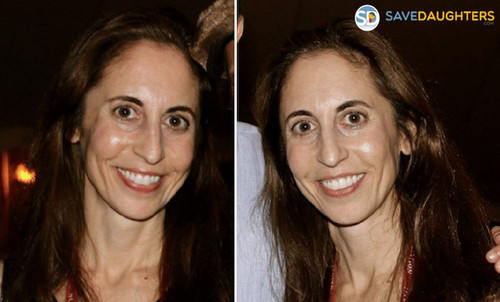 Elizabeth Hirschhorn Parents, Wikipedia, Husband, Net Worth.jpg