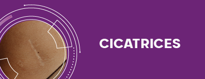 cicatricure BANNER CICATRICES mobile (1).png