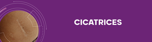 cicatricure BANNER cicatrices desk (2).png