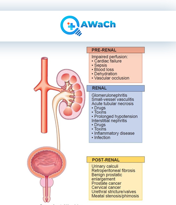 Acute kidney injury Copy.png