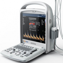 2D color doppler Ultrasound System.png