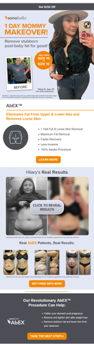 Screenshot 2023 09 13 at 17 41 13 Mommy Makeover An Unfiltered Review.png