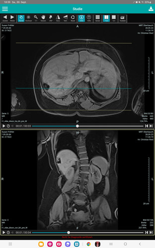 Screenshot 20230930 183940 HealthDataSpace Access Code.jpg