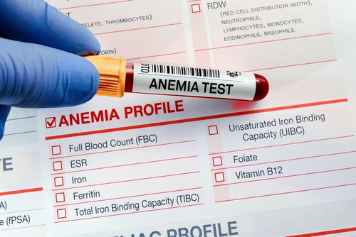 Anemia (1).jpg