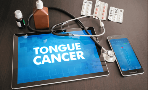 Tongue Cancer (1).png