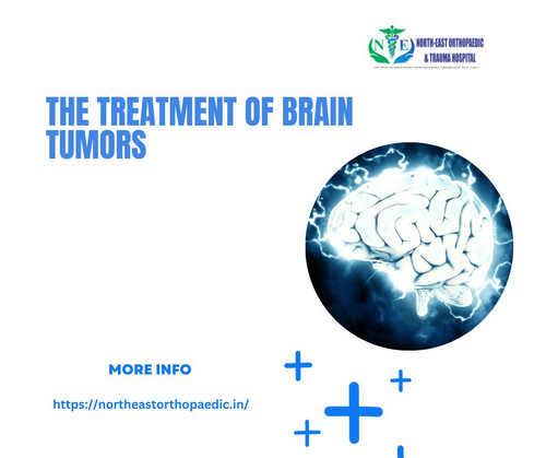 The Treatment of Brain Tumors.jpg