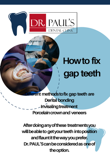 how to fix gap teeth 1.png