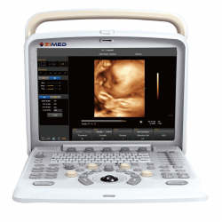 4D color doppler Ultrasound System.png