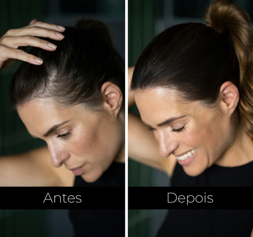 toppik antes depois mulher woman hair fibers before after.jpg