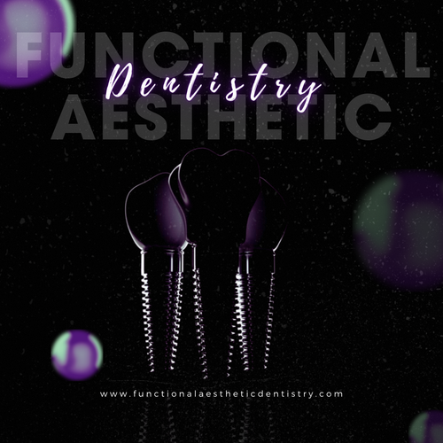 Dental implants Summerlin.png