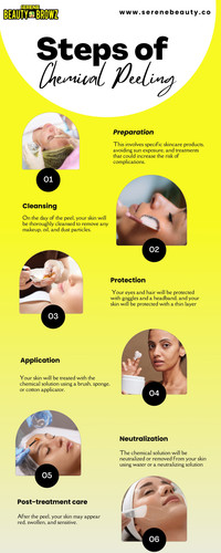 Chemical Peeling Infographics.jpg