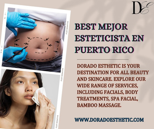 Best Mejor esteticista en Puerto Rico.jpg