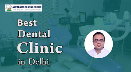 Best Dental Clinic in Delhi - Advance Dental Clinic.jpg