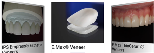 Dental Veneers.png