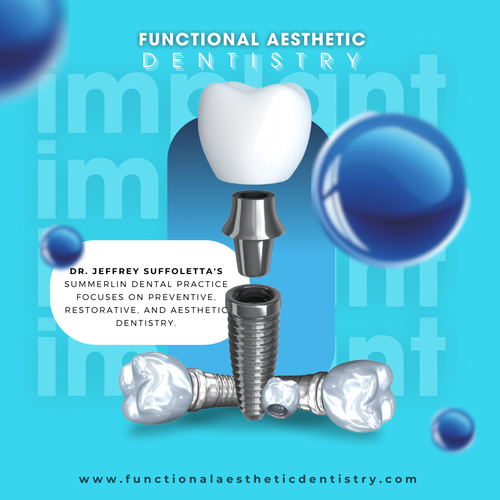 Dental Implants a Paradigm Shifts in Modern Dentistry.png