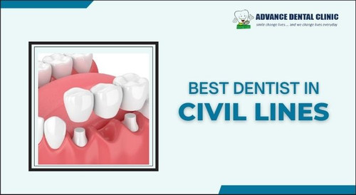 Best Dentist in Civil Lines – advancedentalclinic.jpg