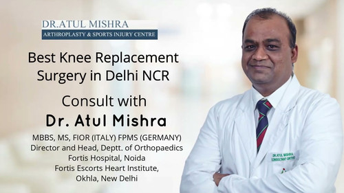 Best Knee Replacement Surgery in Delhi NCR, Total Knee surgeon.jpg